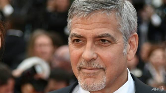 George Clooney Luka-luka Akibat Kecelakaan Skuter di Italia