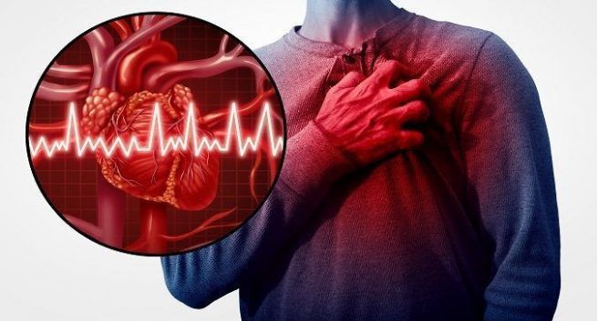Serangan Jantung Meningkat di Kalangan Orang Muda