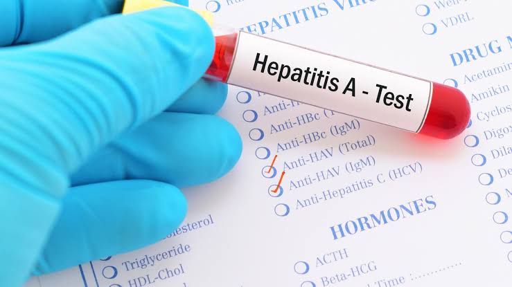 Kasus Hepatitis A di Depok, Ini Penyebabnya Menurut Kemenkes