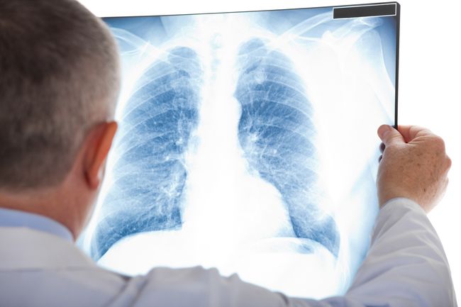 Vaksin Pneumonia Buatan India Lebih Terjangkau Dari Vaksin yang Sudah Ada