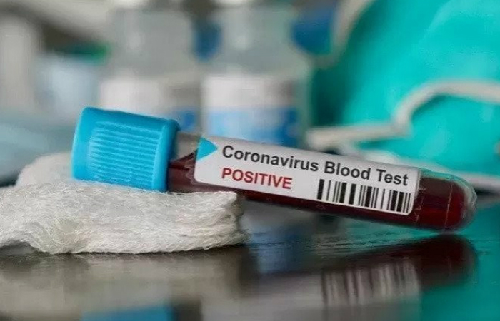Tambah Terus, Sudah Lebih 9,5 Juta Orang di Dunia Terinfeksi Corona