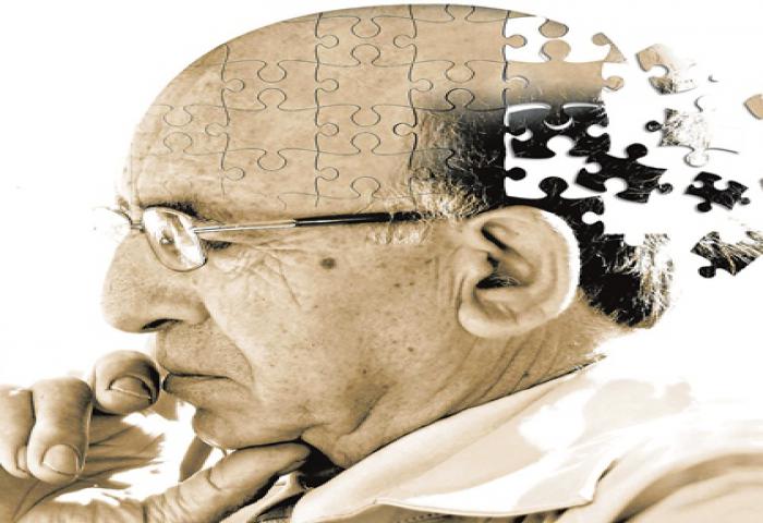 Penurun Kolesterol Statin Dapat Kurangi Risiko Alzheimer